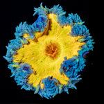 Ultra Rock Flower Anemone - riptide aquaculture llc